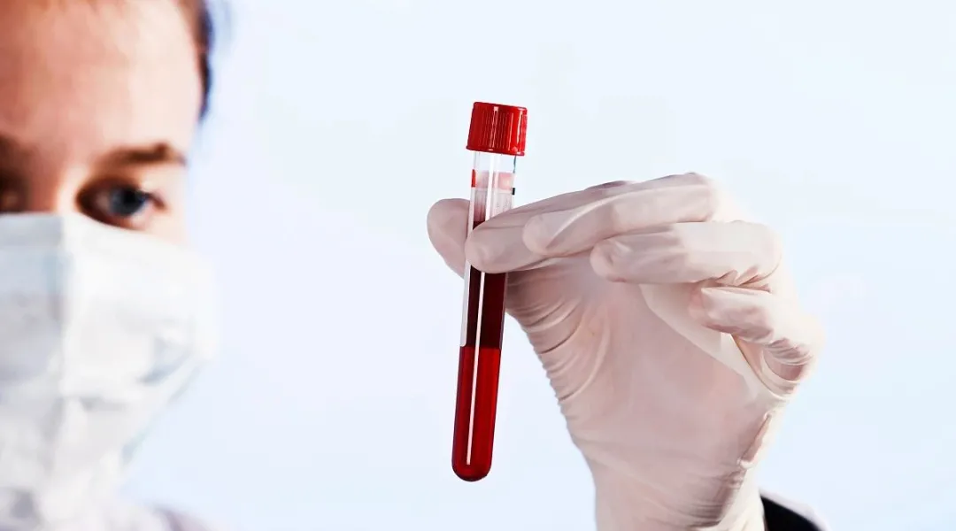 胆碱酯酶检测异常可能是因其他因素引起，不一定是肝功能异常引起