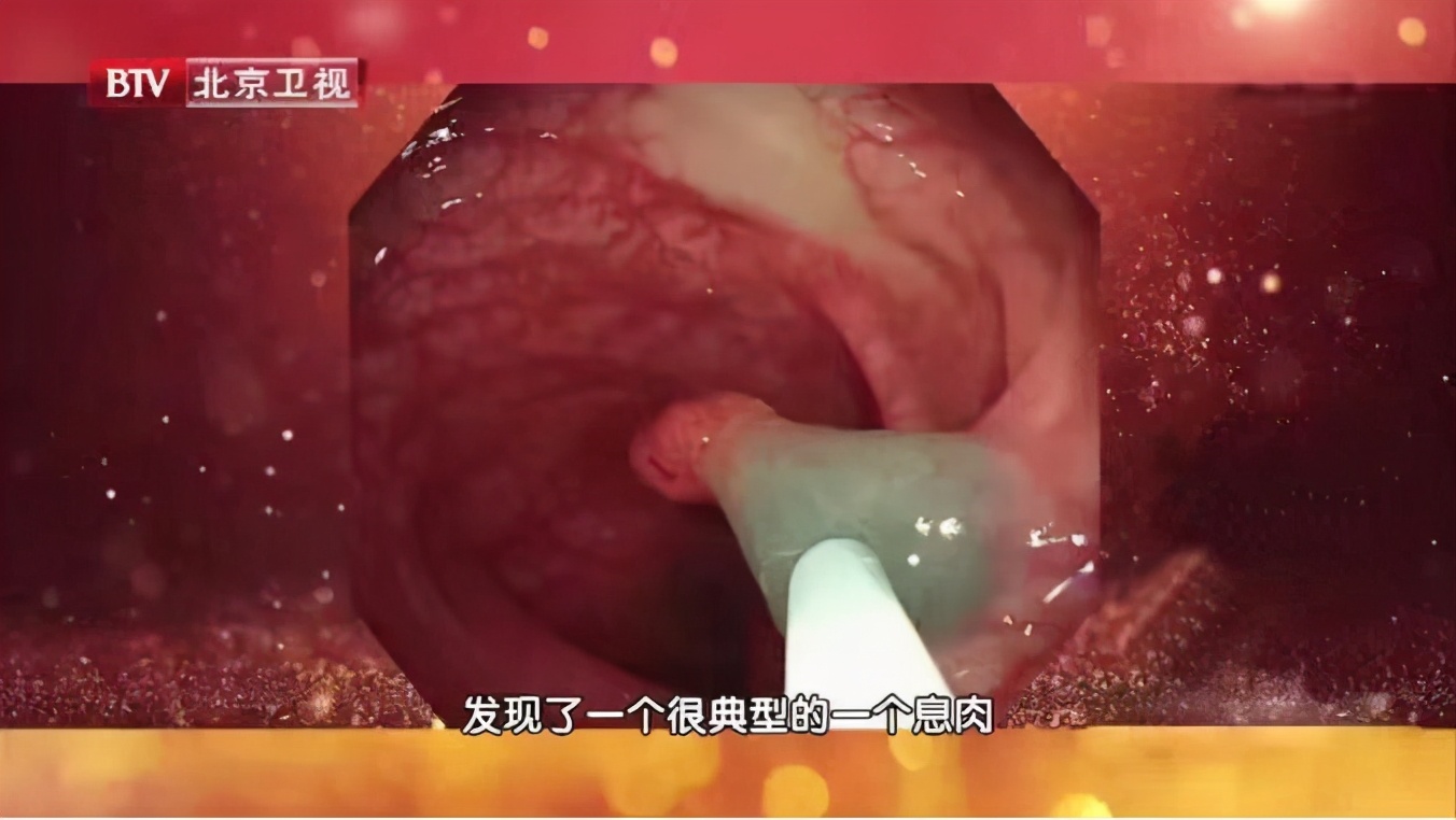 让屁增多的“元凶”，有些你一定想不到，这三种异味屁，可能是疾病前兆，可别忽视