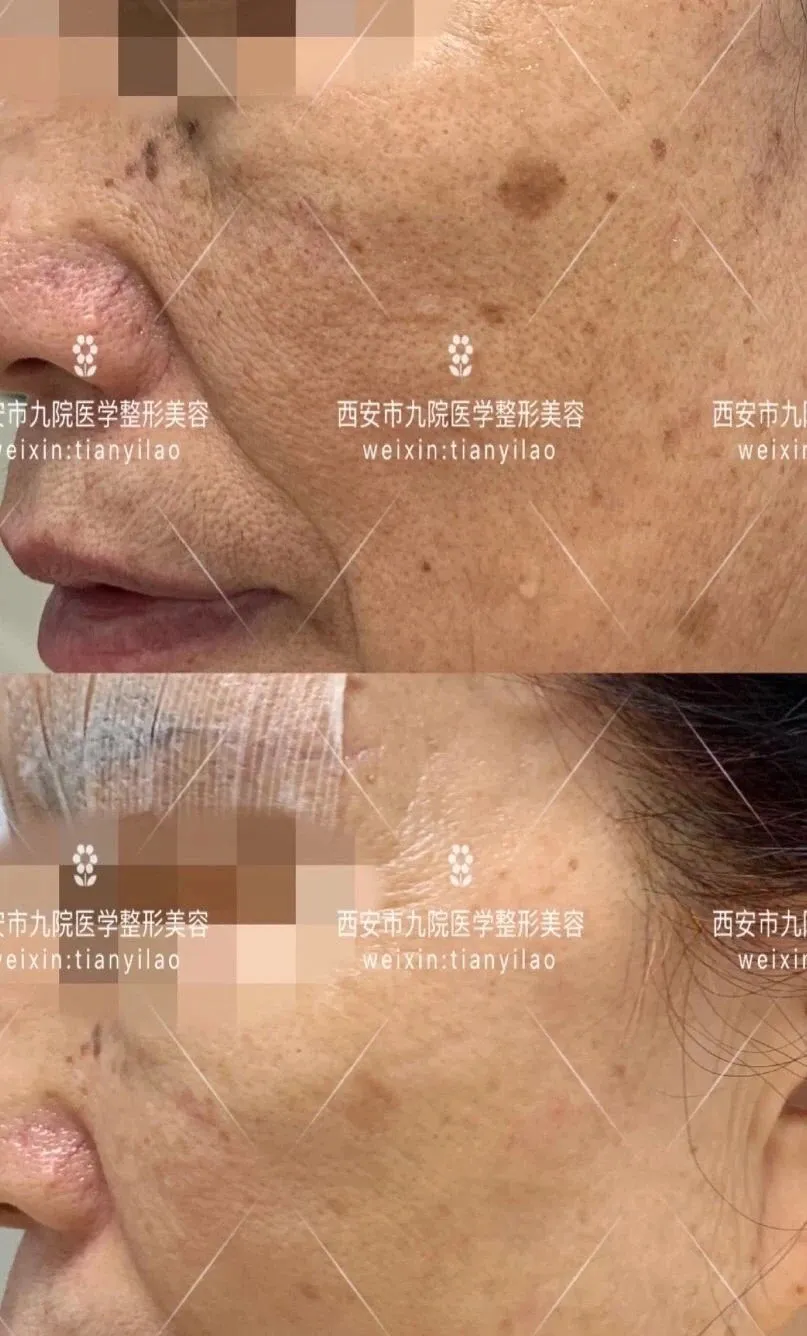 【活动播报】西安市第九医院“暑期特惠”活动启动啦!