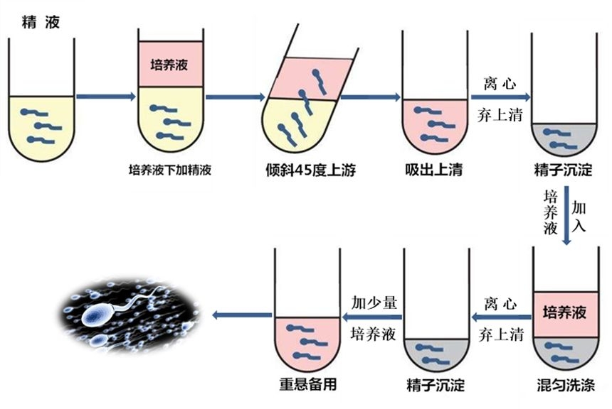 人工助孕多少钱(看呆医生) 