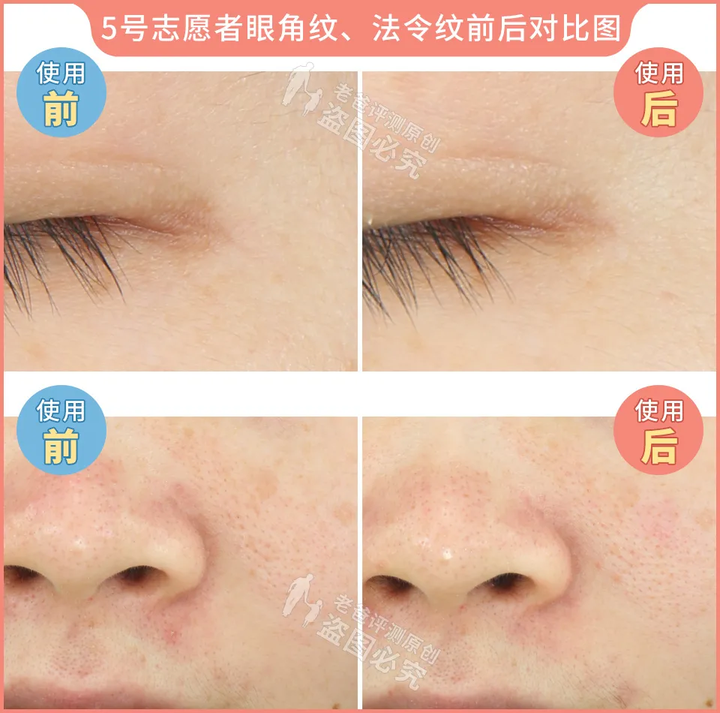 网红家用美容仪真的有效吗？2个多月的跟踪实测结果来了