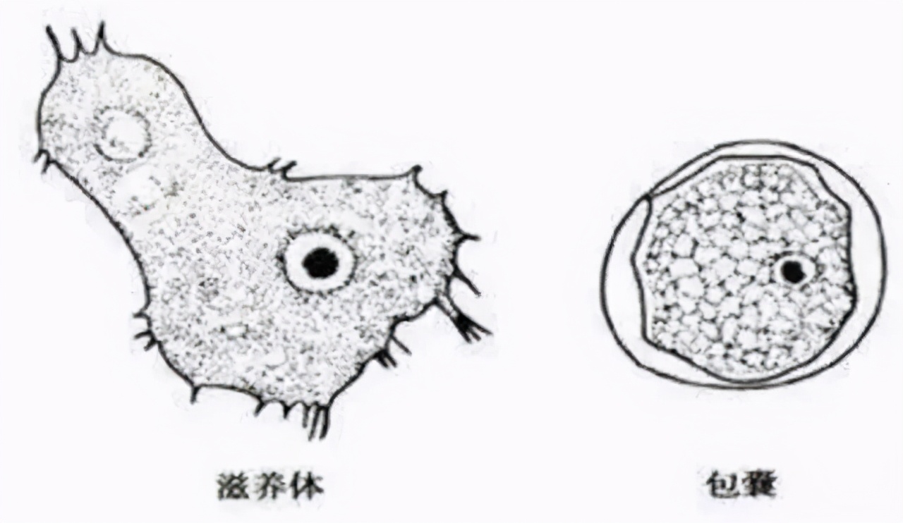 戴隐形眼镜后险丧命！医生忠告：隐形与美瞳很多人都用错了