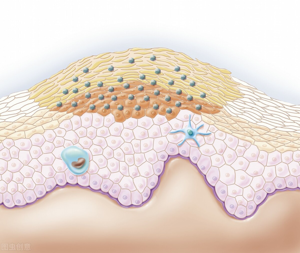 尖锐湿疣有哪些症状?"浪漫"过后,怎样才能知道自己是否中招了