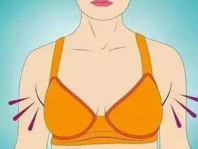 副乳癌的早期症状图片(副乳是癌前兆) - 赤虎壹号