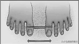大脚骨的痛你懂吗？患者平均忍耐时间长达23年！