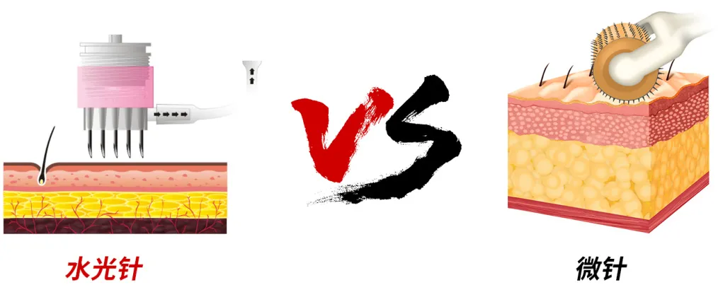水光针 VS 微针,终于知道谁更适合我啦
