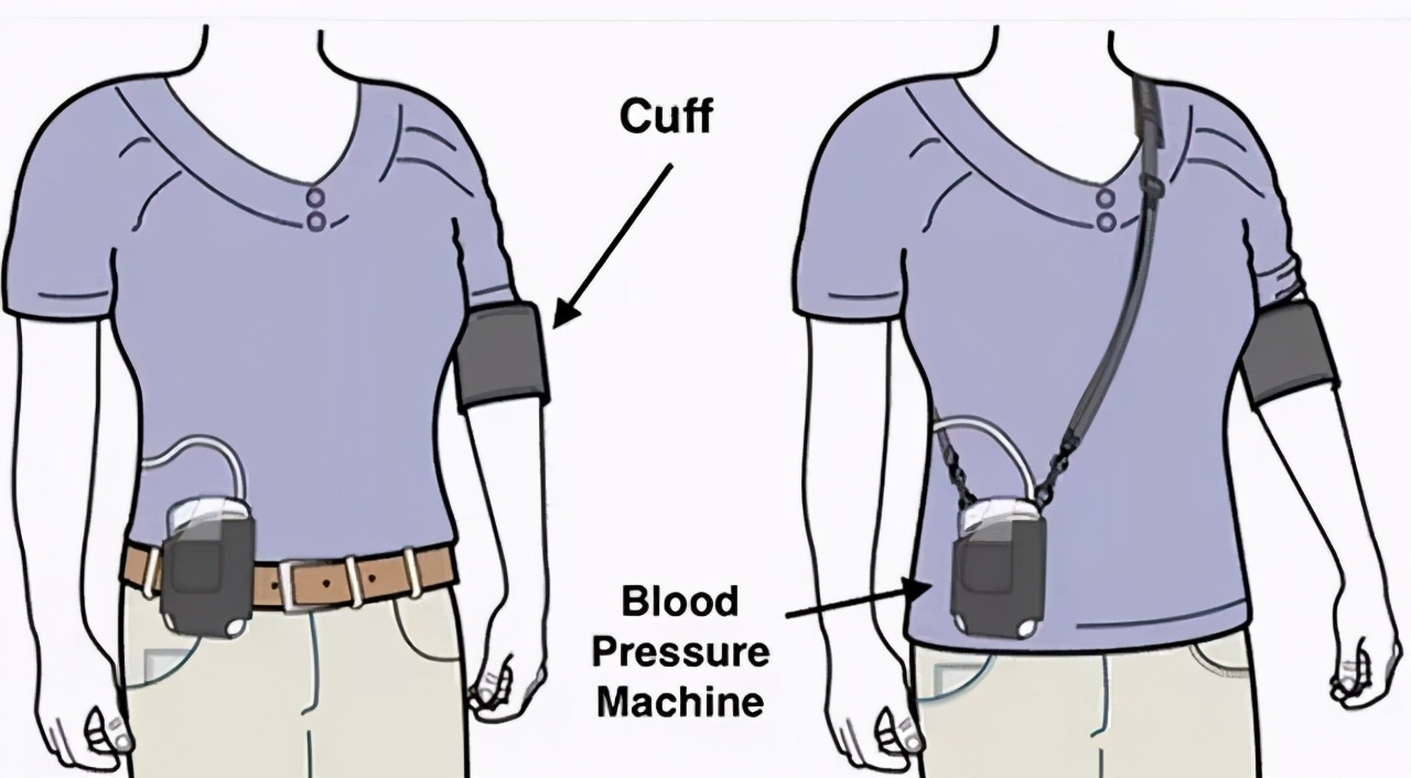 高血压诊断之利器：动态血压监测