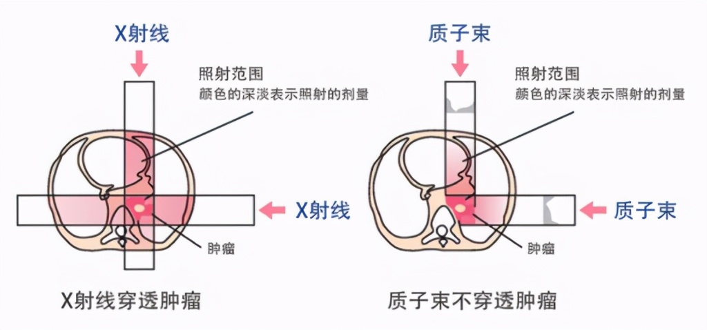 李宗伟是美国的吗(李宗伟癌症治愈，花费近千万？先进抗癌治疗法何时能“白菜价”？)