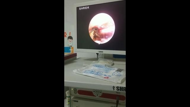 男子骑着电动车 耳朵钻进活飞蛾，知道这招可以急救