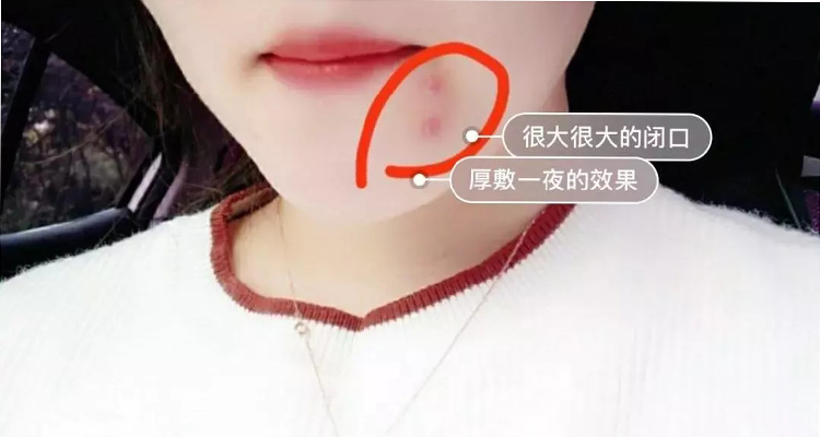 王艳、秦海璐、刘亦菲都在用片仔癀，谁用谁白，受到众多明星青睐