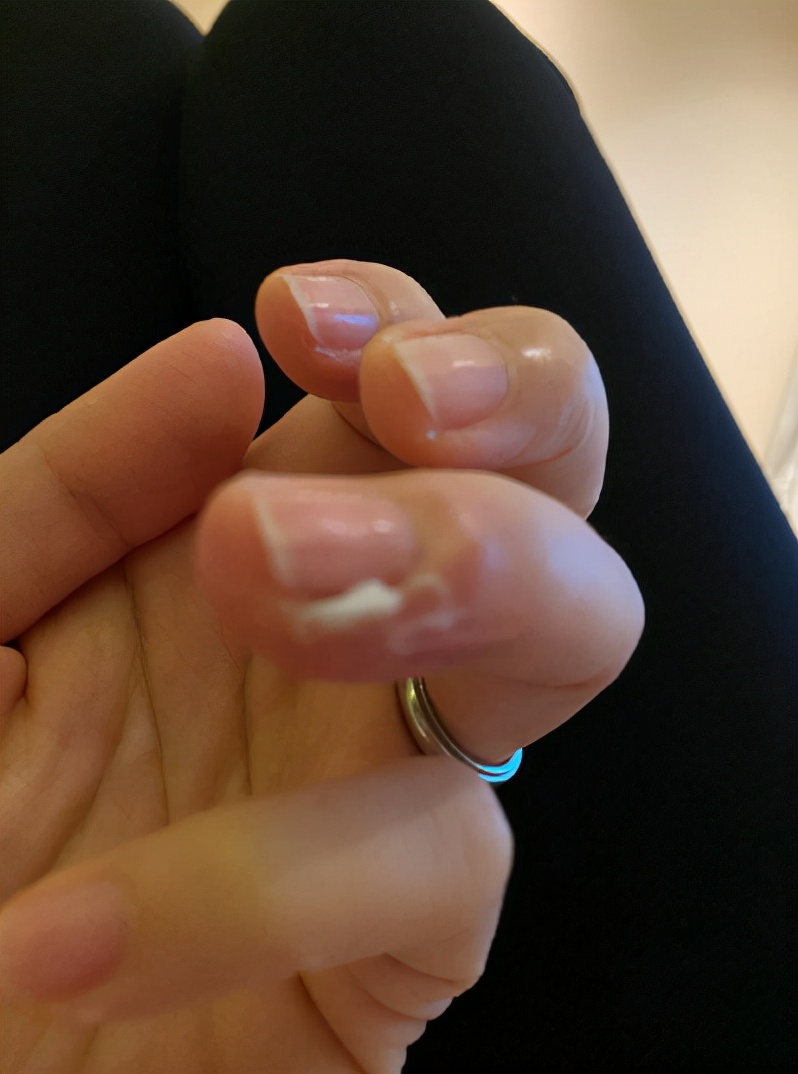 张晋夫妇现身机场，蔡少芬手受伤坚持给粉丝签名，还自侃手丑好逗