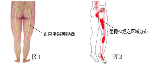 腰椎疾病、腰椎间盘突出你想知道的事全集！