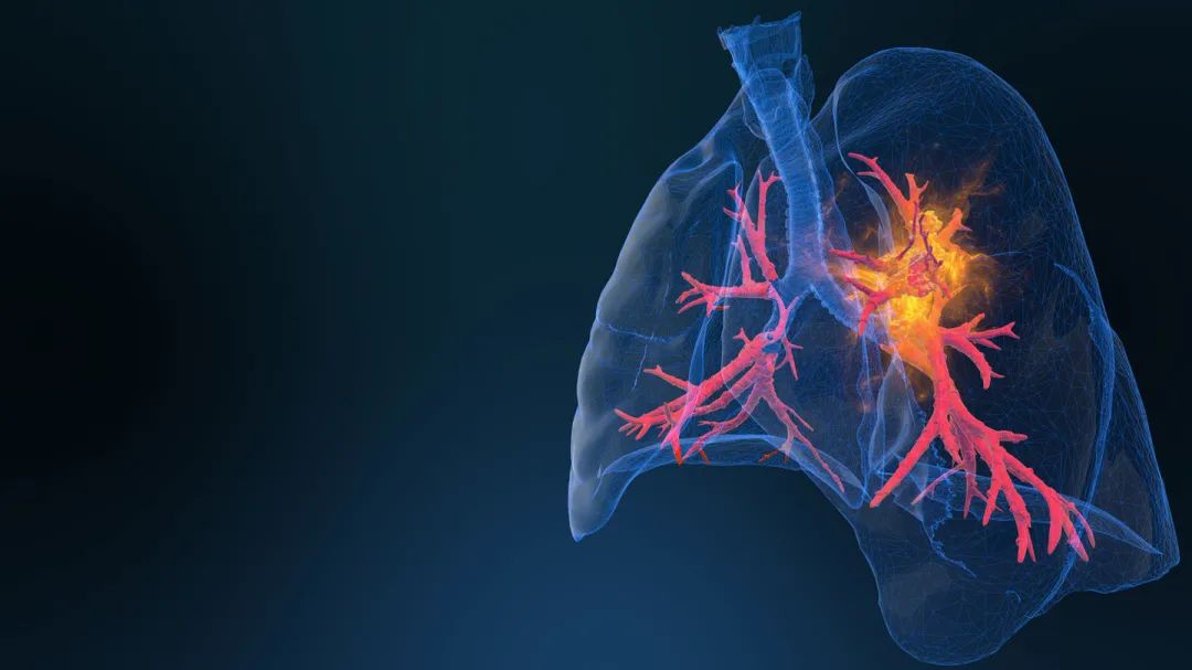 河南唯一！一次27.8万的肿瘤治疗神器，即将落户郑大一附院