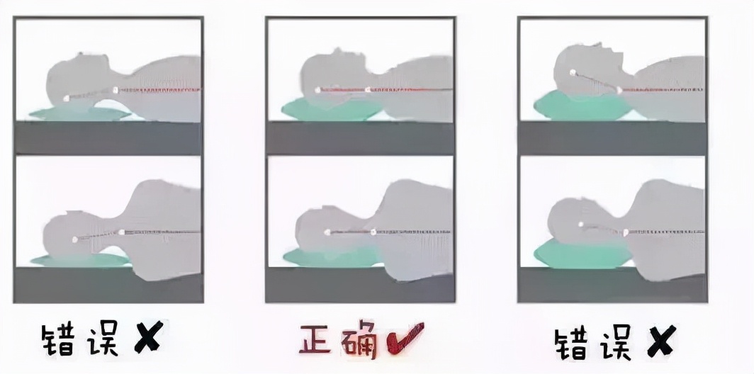 25岁头疼头晕恶心，交感神经型颈椎病中医辨证气阴两虚夹瘀型