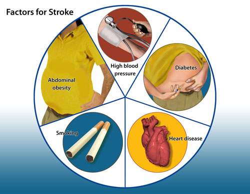 发现腔梗，就要吃阿司匹林吗？医生提醒：做到这5件事更重要