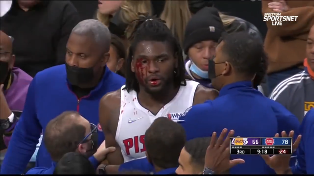 nba哪些人盖帽过浓眉哥（詹姆斯肘击斯图尔特，后者赛后缝5针，浓眉：都知道詹姆斯不脏）