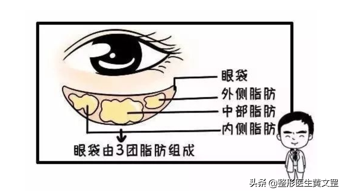 「眼综合手术科普」眼综合≠割双眼皮，TA包含这8个项目