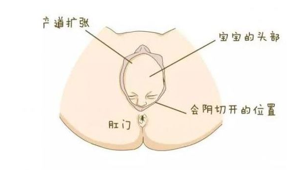 图解产妇顺产全过程，看看宝宝到底怎么出生的，胆小勿进