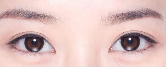 怎么判断丹凤眼适合哪种双眼皮双眼皮有什么类型看看你的脸型适合哪种