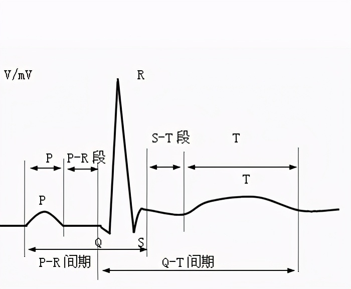 普通人怎么看心电图？医生说：把图上的线条和心脏的跳动结合起来