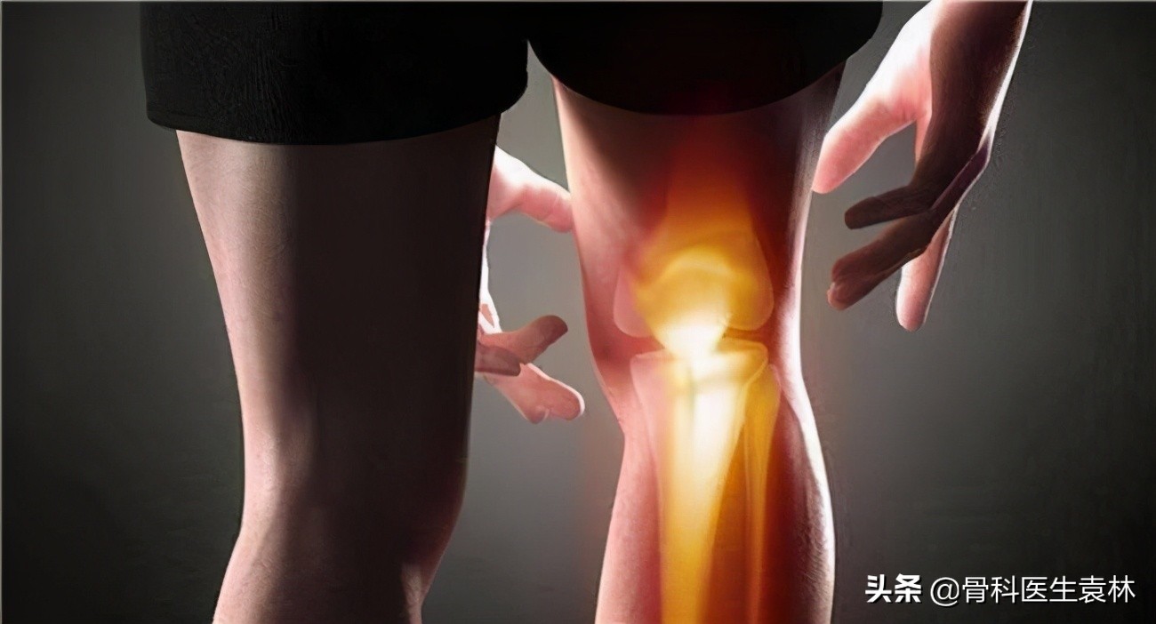「骨质增生」膝盖疼骨质增生怎么治 怎样治疗膝盖部位的骨质增生