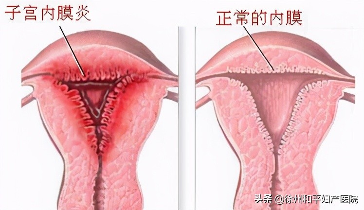 “大姨妈”两天就没了？是不是身体不好？