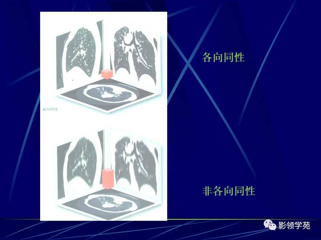 肺小结节影像诊断