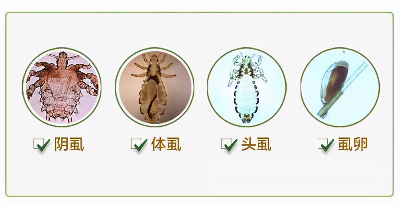 虱子与我们共存百万年,还见证了一段孽缘!为何这几年见不到了?