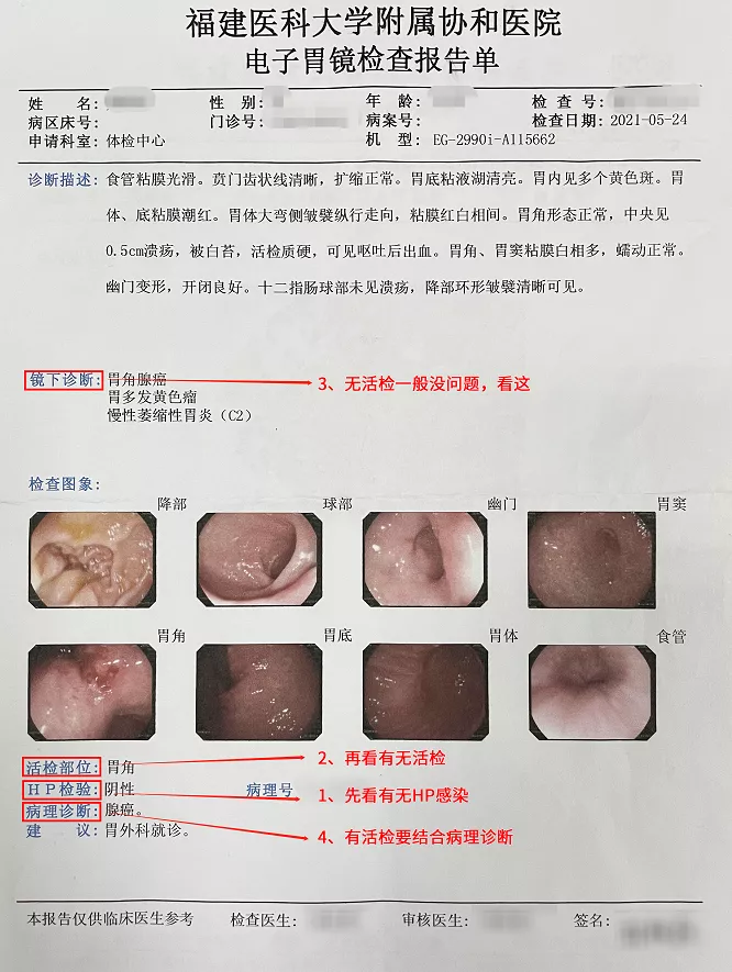 做胃镜能查出「胃癌」吗?不同人群多久做一次?对照这张表看看