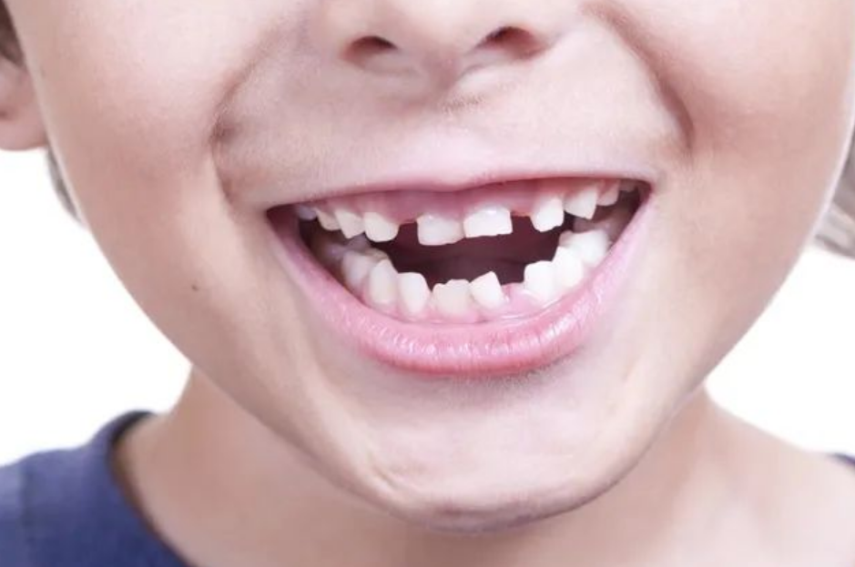 儿童门牙长歪图片(宝宝旧牙整齐) - 赤虎壹号