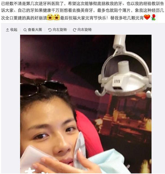 刘涛悔青肠子的同款烤瓷牙,满口300万,结果牙齿会发光?