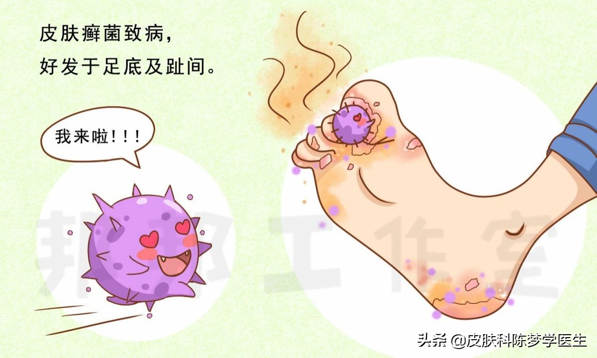 十几年顽固脚气怎么办？十大有效治疗药物排名推荐
