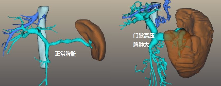 肝炎、肝硬化、肝腹水，三种肝病的检查和治疗，都是干货