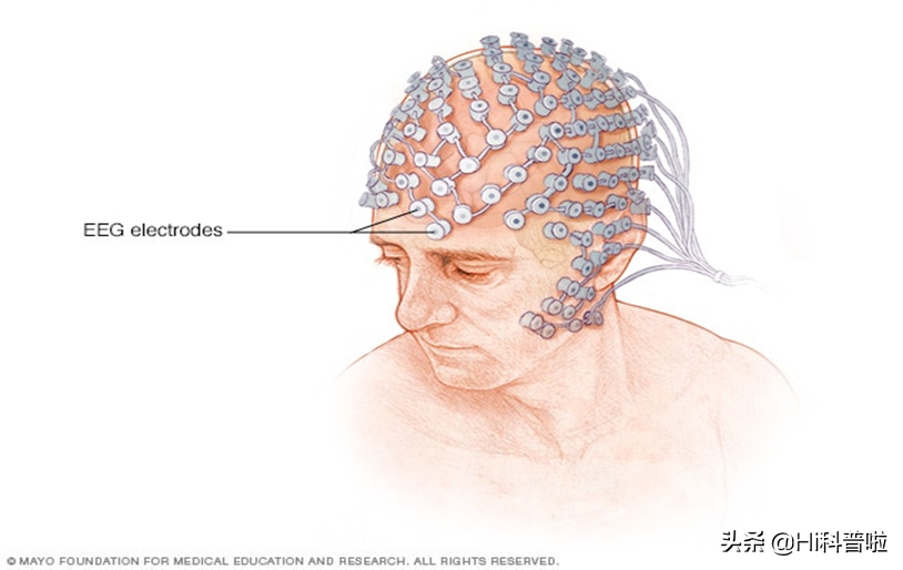 临终告别需谨慎！科学已证明，人在死亡后仍能听到周围的声音