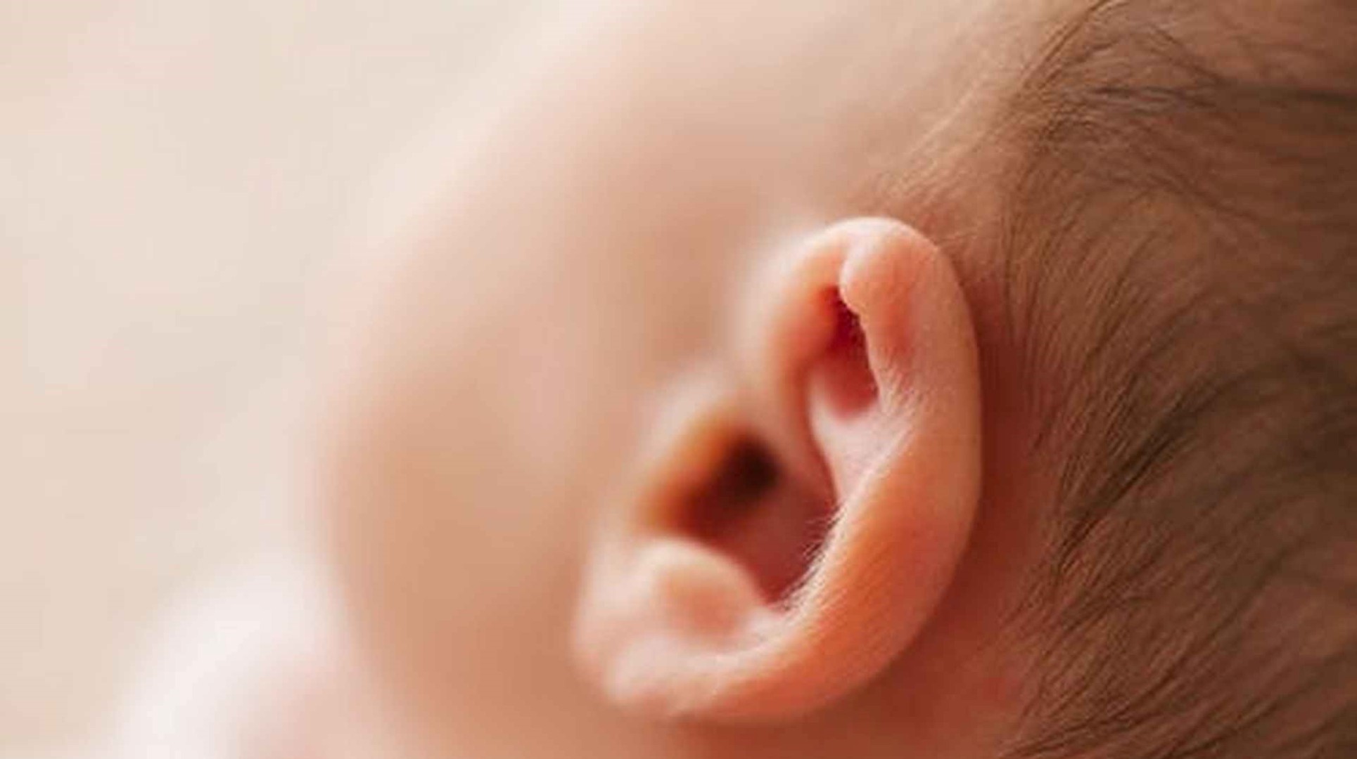 婴儿耳朵里边黄痂图片（有种）-幼儿百科-魔术铺