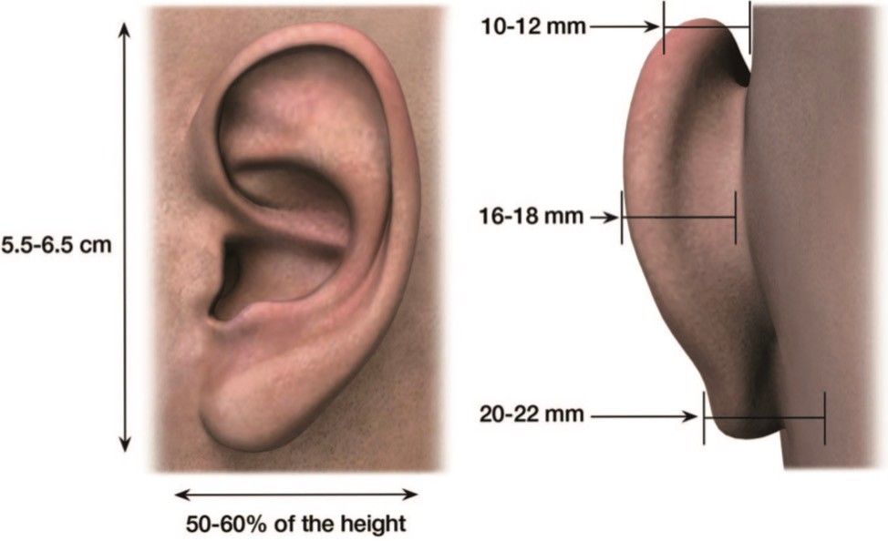 贴发耳和招风耳哪个更好看？耳畸形修复余文林在线解答