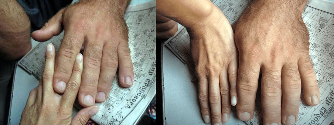 世界杯腕力冠军("乌克兰绿巨人"丹尼斯,世界腕力冠军,还能与勒万一战