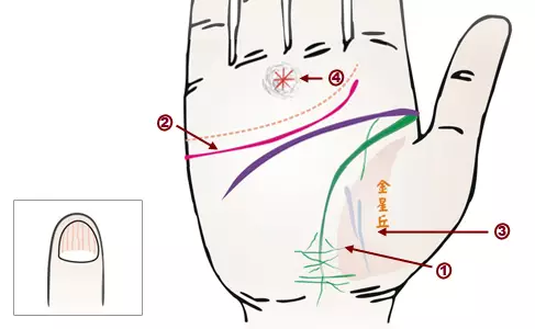 掌纹诊病：可以诊断肝癌、糖尿病、高血压、妇科病、脑溢血
