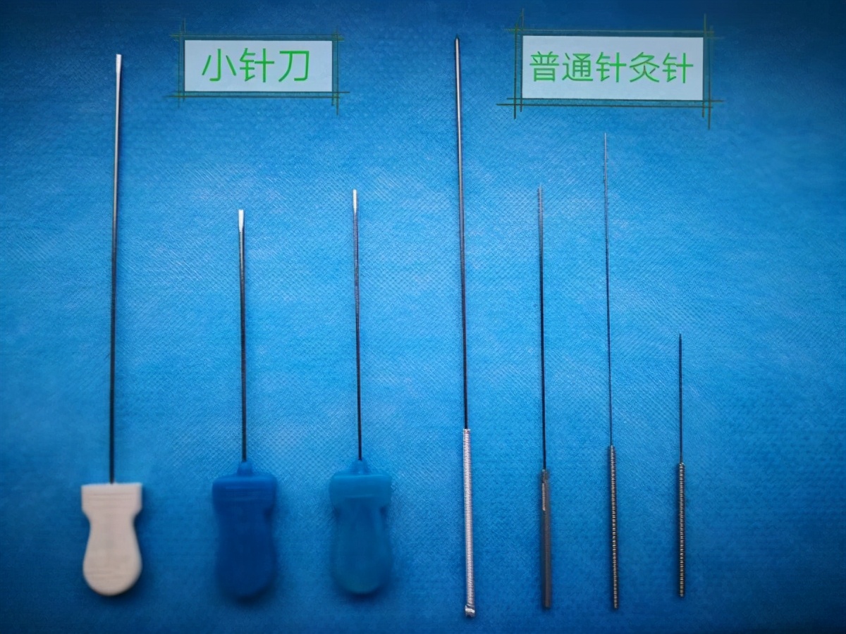 小针刀治疗颈椎病是骗人的吗？医生告诉你真相