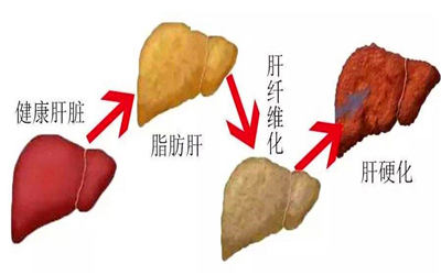 乙肝五项检查正常标准及意义解析