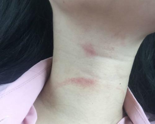 女儿脖子上惊现吻痕,父母大怒,网友:养孩子不能只给钱