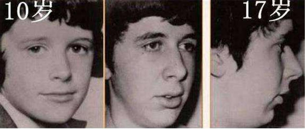 儿子脸型像“大猩猩”，妈妈调侃“长残了”，朋友提醒才知不对劲