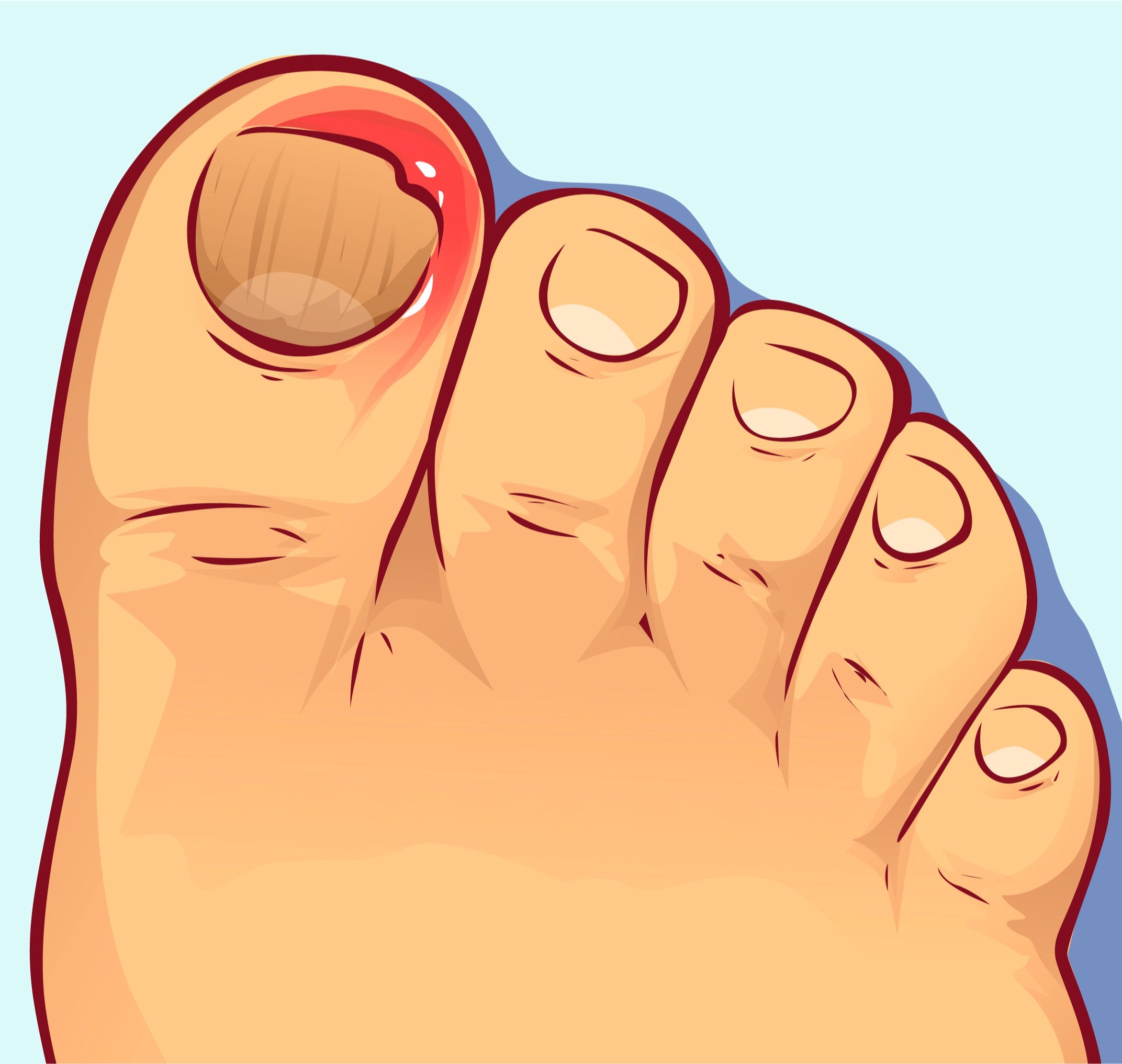 遇到这个疾病该咋办?请看此文