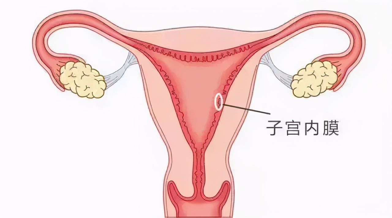 子宫内膜的薄厚关乎是胚胎能否移植的重要指标,过厚过薄都不适合移植