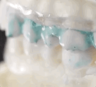 牙科拜拜,用它在家也能洗牙,每次不到2毛