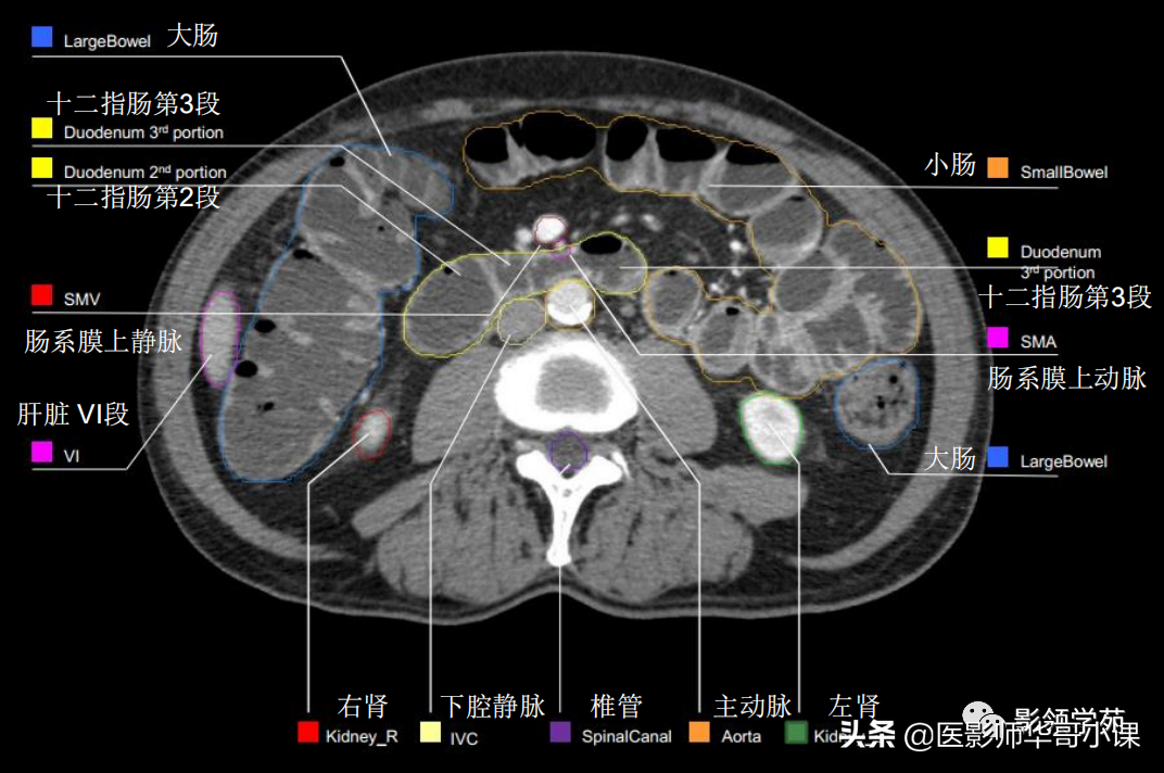 「高清解剖」腹部ct影像学解剖图谱(肝脏分叶分段)