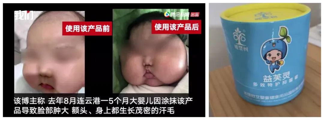 mesuca是什么牌子(母婴315：过去一年，哪些品牌宝宝用品上了质检“黑名单”？)