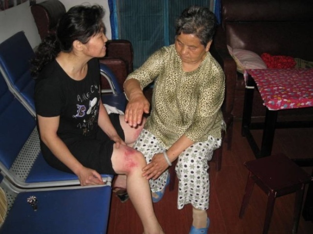 可是,有一部分老年人觉得打得越重,出痧越多就对身体越好,因此而导致