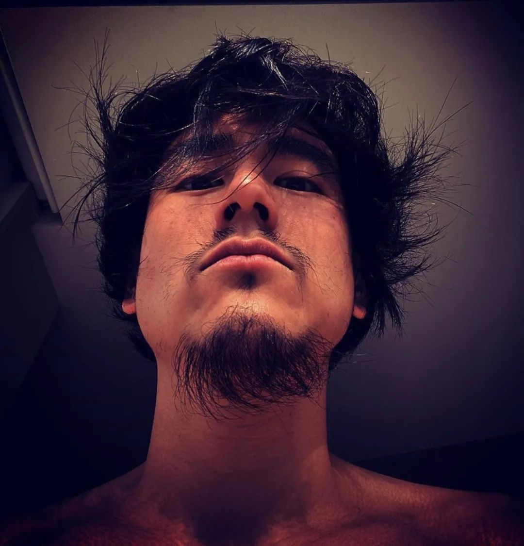 鱼尾纹也不减帅气减轻鱼尾纹