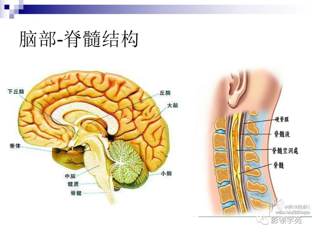 小脑扁桃体下疝畸形概述